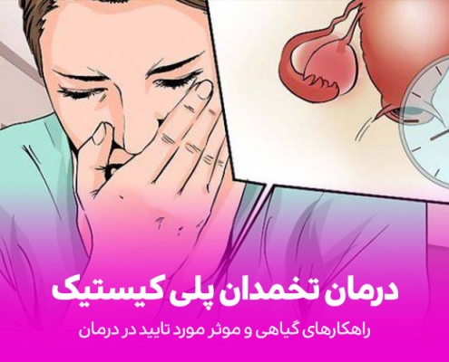 درمان کیست تخمدان با درمان های گیاهی