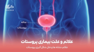 نشانه ها و علت ابتلا به پروستات