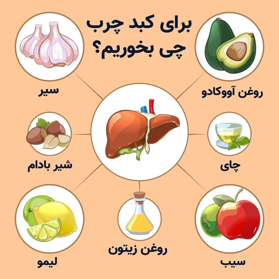درمان کبد چرب بدون دارو
