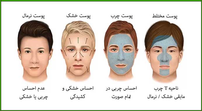 روتین مراقبت از پوست برای جوش و لک​