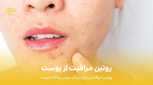 روتین مراقبت از پوست