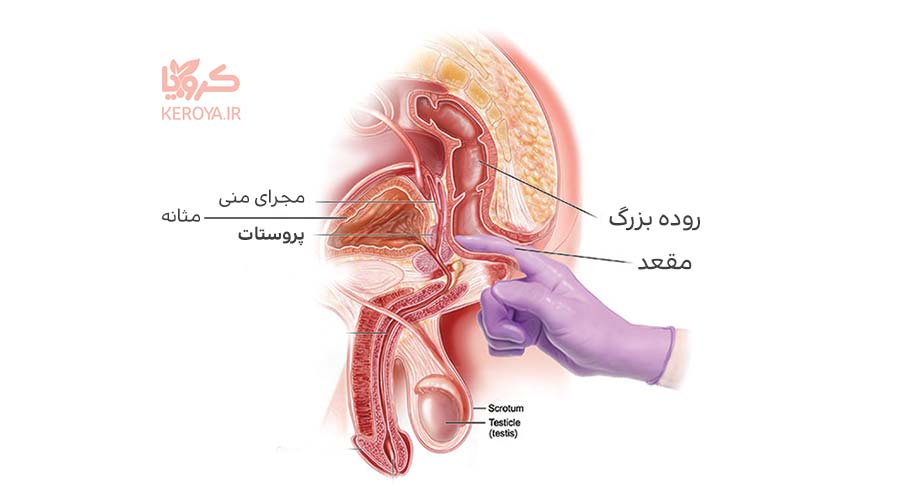 علائم، نشانه ها و علت بیماری پروستات